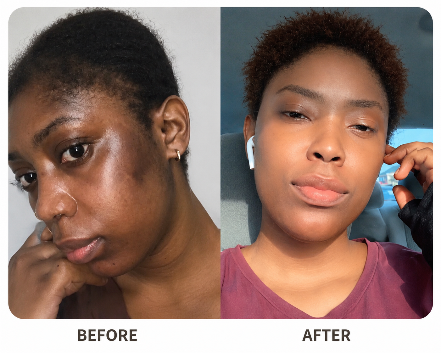7 Days Fast Whitening Cream ✨